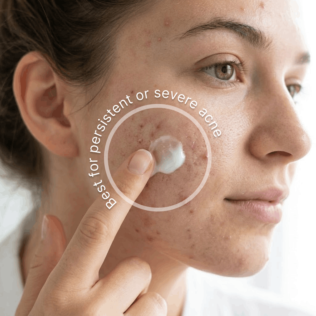 Applying The Advanced Acne Solution to persistent acne